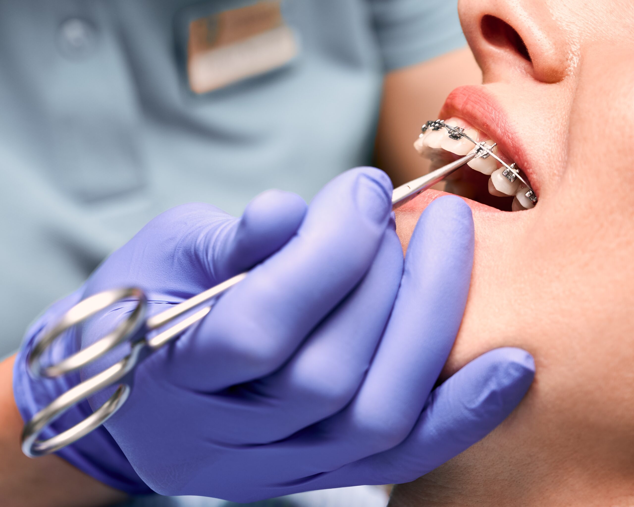 Orthodontic treatment